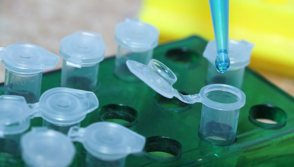 Leptospirosis